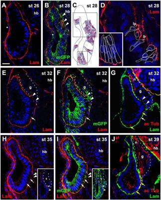 Otic Neurogenesis in Xenopus laevis: Proliferation, Differentiation, and the Role of Eya1